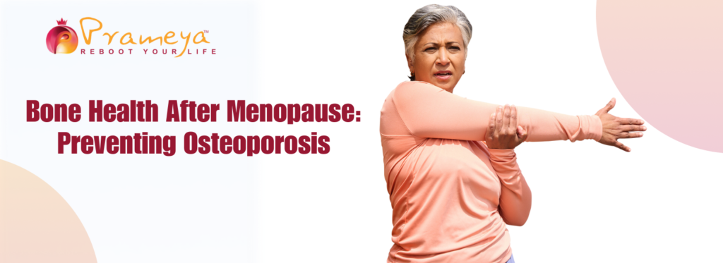 Bone Health After Menopause: Preventing Osteoporosis